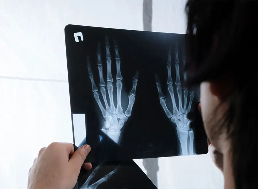 Doctor viewing an xray of hands